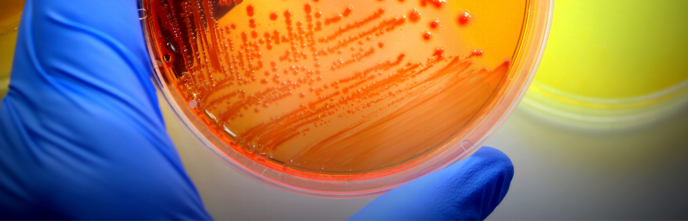Microbiology with Lab | UC San Diego Division of Extended Studies