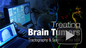 9-4-14-treating-brain-tumors-(1).jpg
